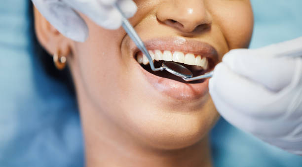 Best Broken or Cracked Tooth Emergency Dentist in Earlvle, IL
